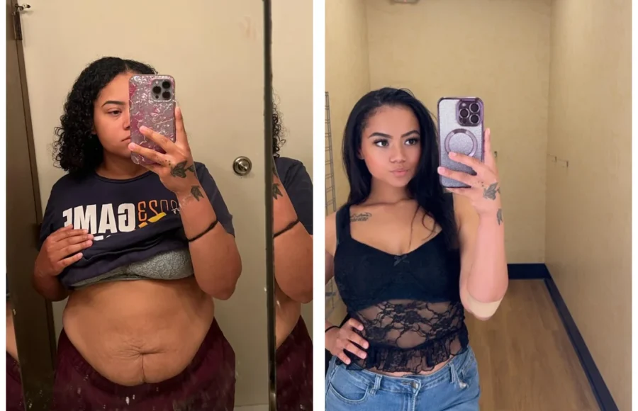 before-and-after-v0-w71xk0az2t5d1 before-and-after-v0-w71xk0az2t5d1